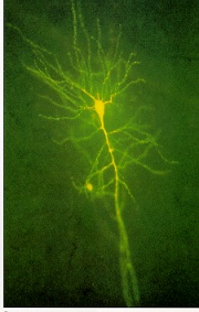 neuron2